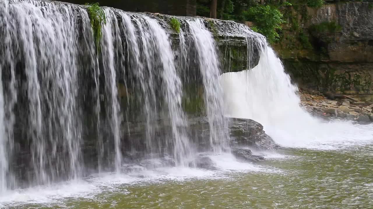 在上白内障环旁视频素材