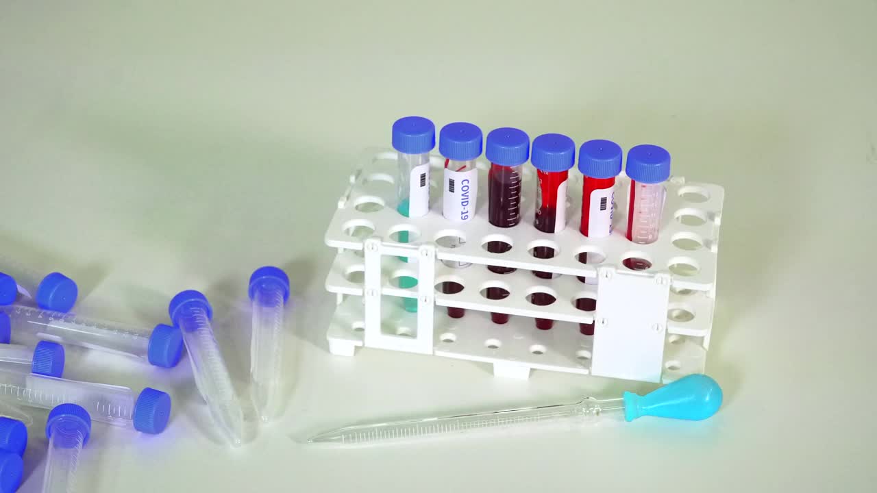 科学实验设备- COVID-19疫苗血液样本视频素材