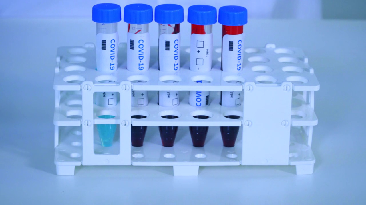 科学实验设备-手将COVID-19疫苗血液样本插入试管架视频素材