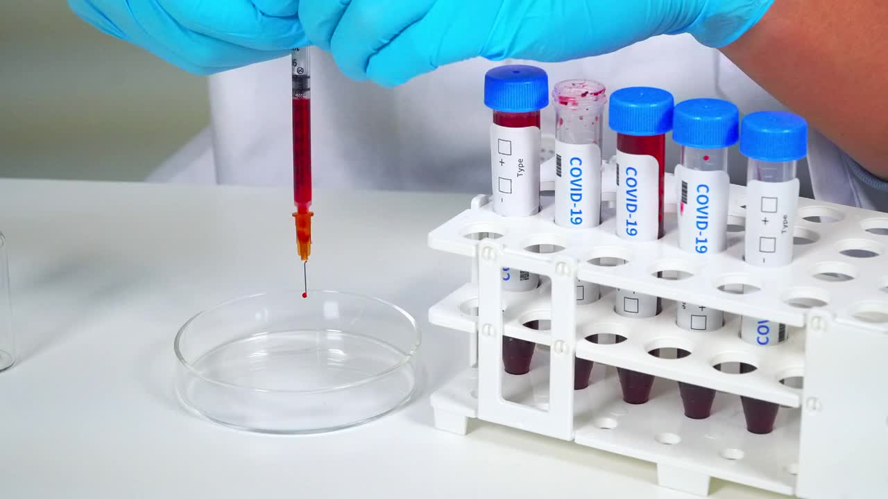 科学实验设备-用手将COVID-19疫苗血液样本放在培养皿上视频素材