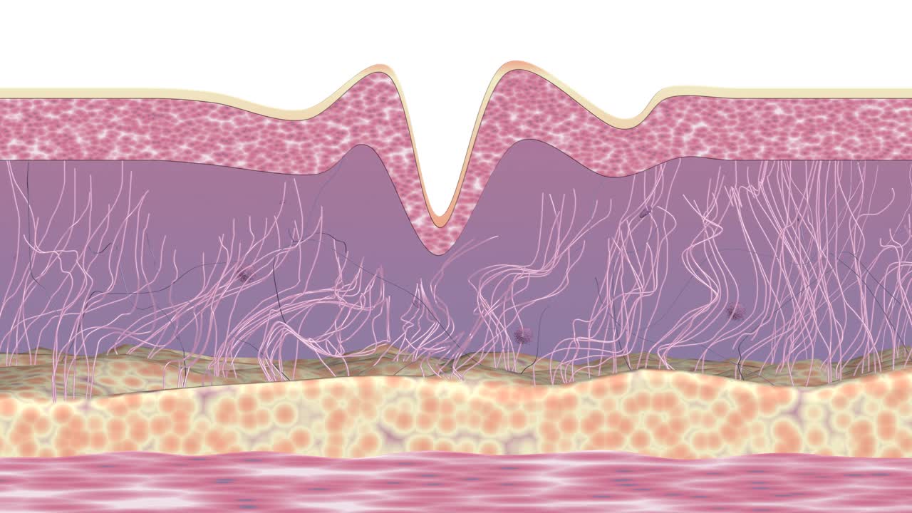 皮肤起皱纹治疗。医学三维动画。视频素材