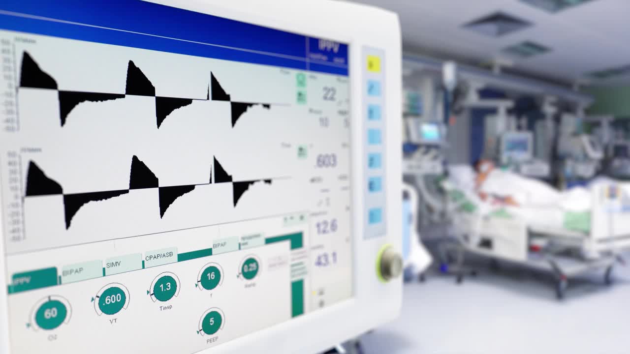 重症监护室肺机械通气，Covid-19大流行视频素材