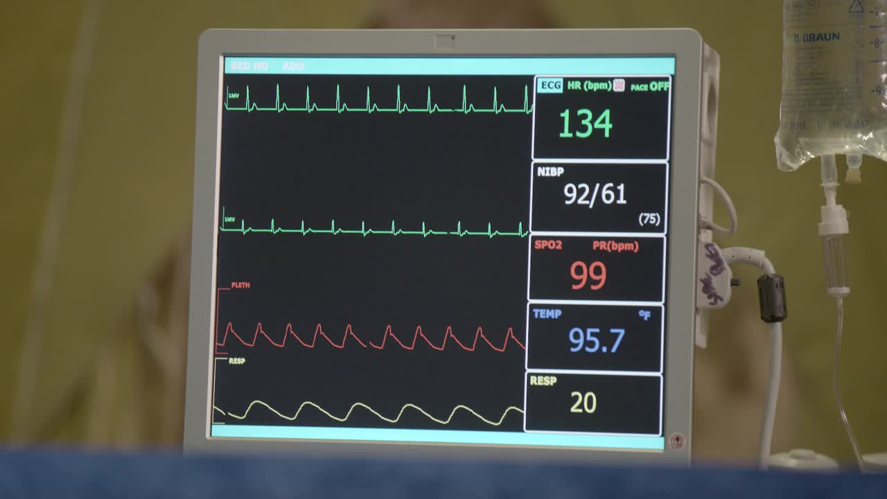 医院或急诊室数字心电图机或心电图机的闭合角度。可见静脉袋和点滴管。机平线。视频素材