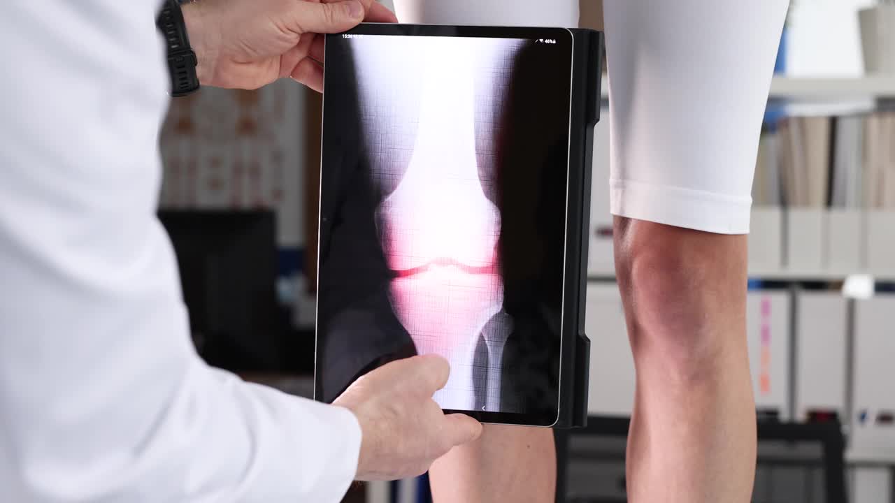 医生使用数码平板电脑4k影像对膝关节进行电脑检查视频素材