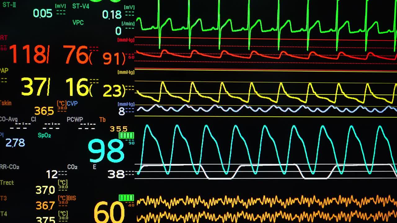 生命体征监护屏幕视频素材