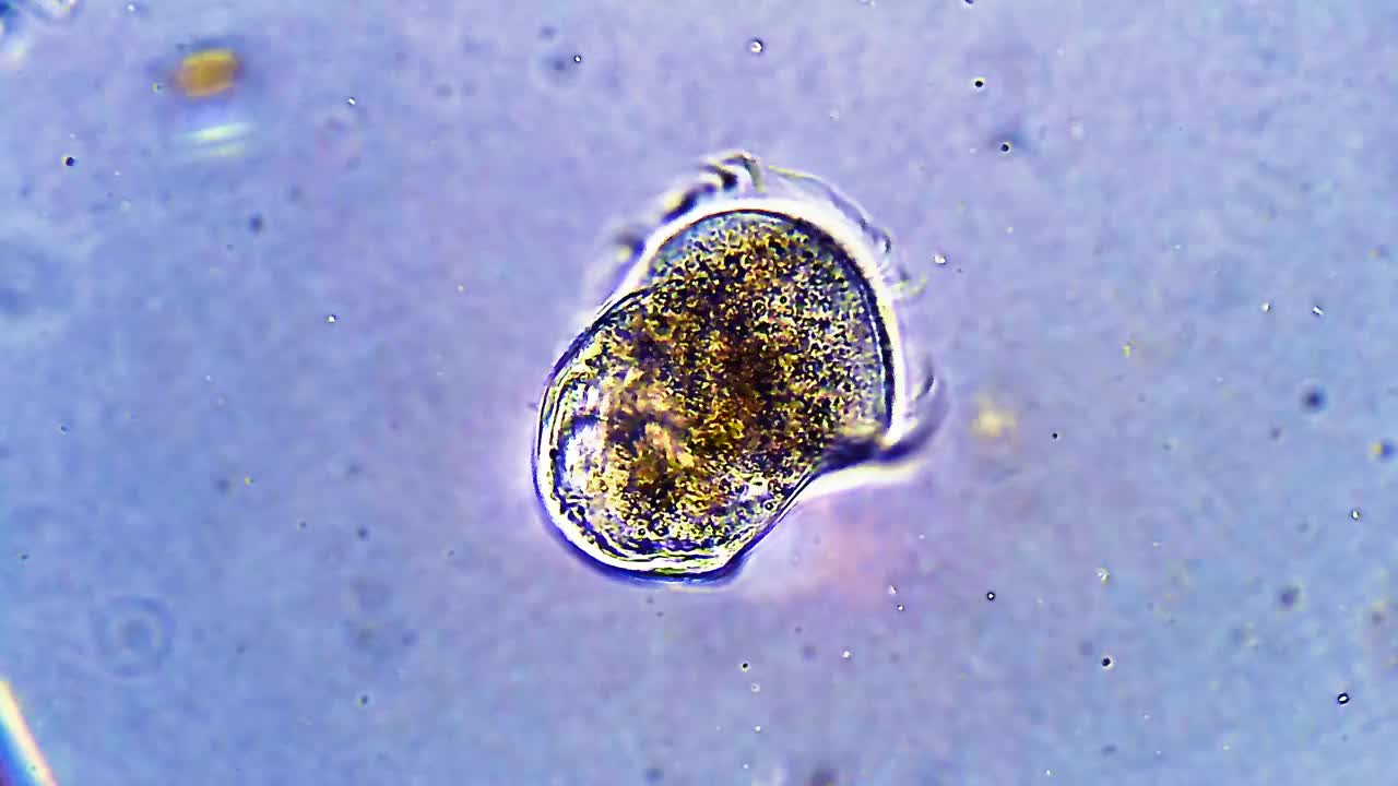微生物- Urocentrum turbo视频素材