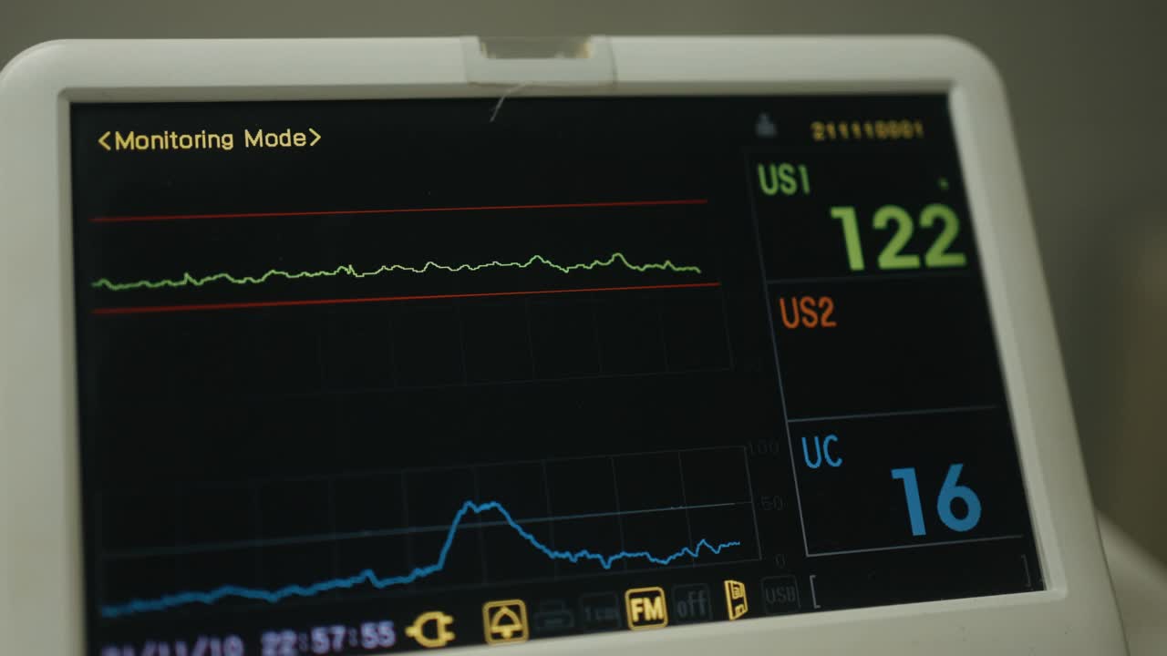 视频心血管内科ICU监护仪与住院患者生命体征视频素材