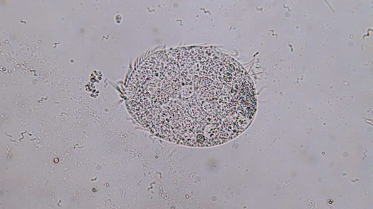 纤毛虫微生物显微镜观察视频素材