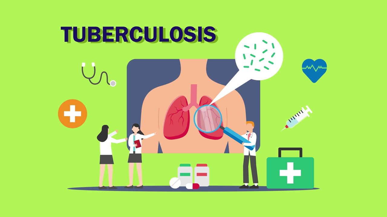 医生正在检查肺部的肺结核病视频素材