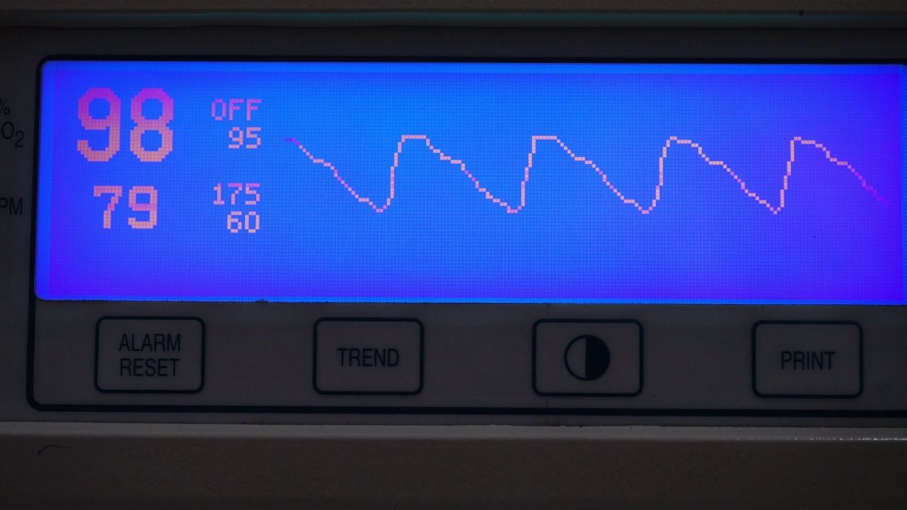 脉搏血氧计视频素材