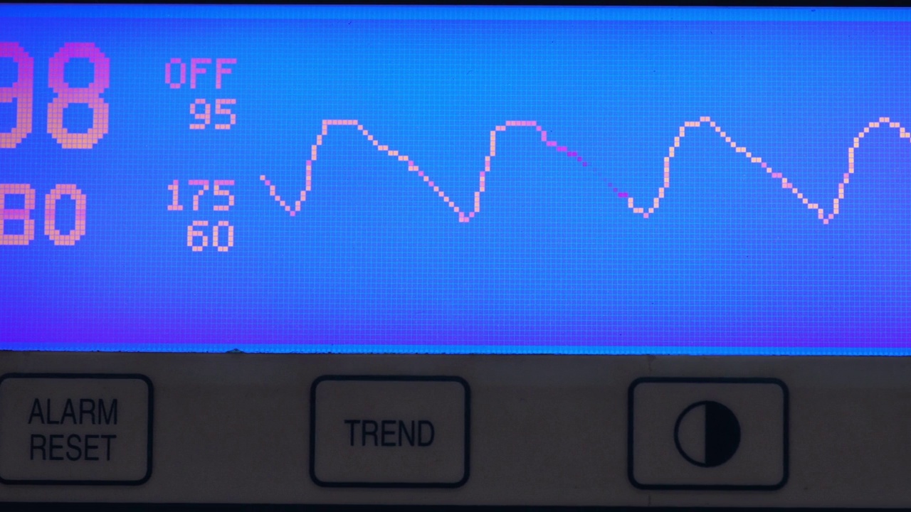 脉搏血氧计视频素材
