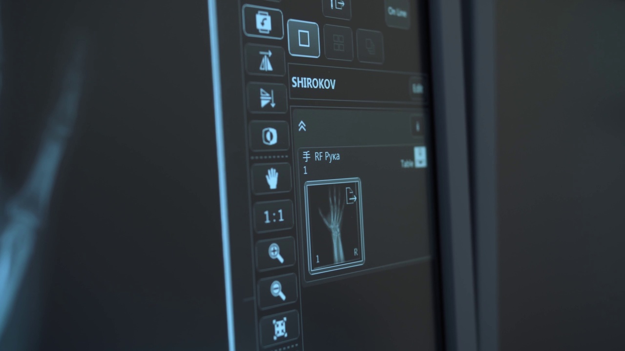 手在医疗设备监视器上的x光特写视频素材