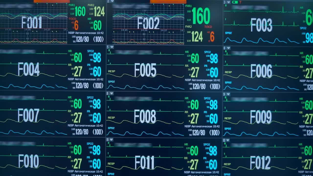 心率监视器屏幕与实时图表和心脏工作的数字数据视频素材