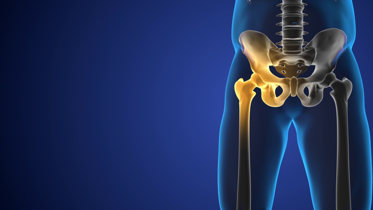 髋关节疼痛3d医学图形视频素材