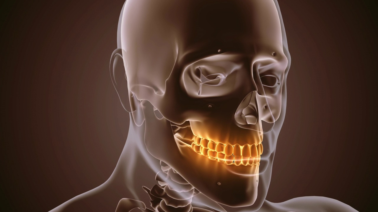 牙齿疼痛的医学动画视频素材