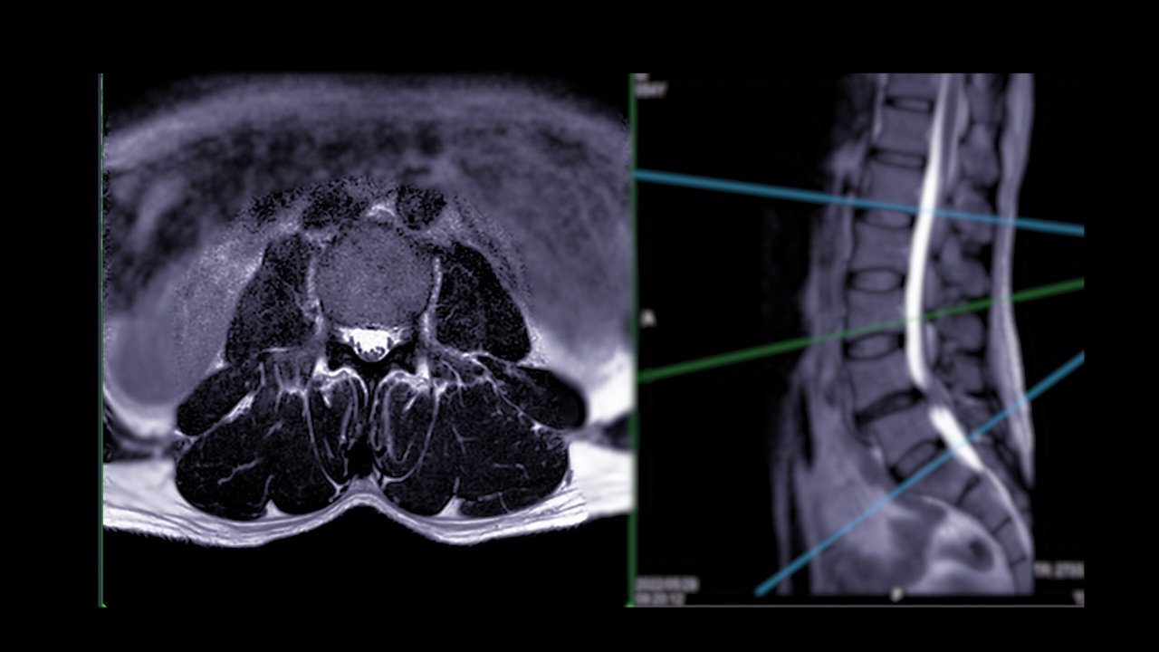 核磁共振成像条件下脊柱。视频素材