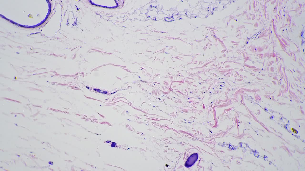 100倍放大显微镜下拍摄的人体皮肤及毛囊切片视频素材