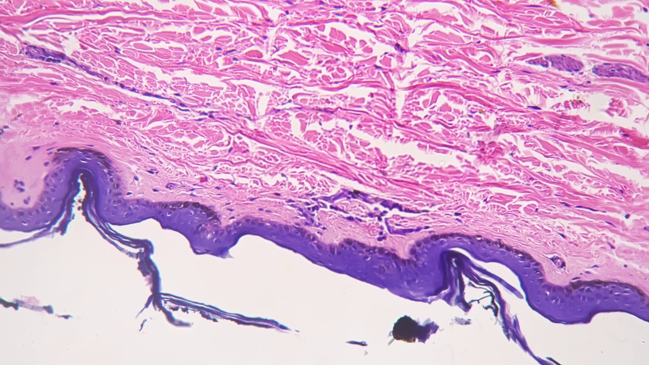 显微镜下200倍的人类皮肤显示汗腺对明亮的领域视频素材