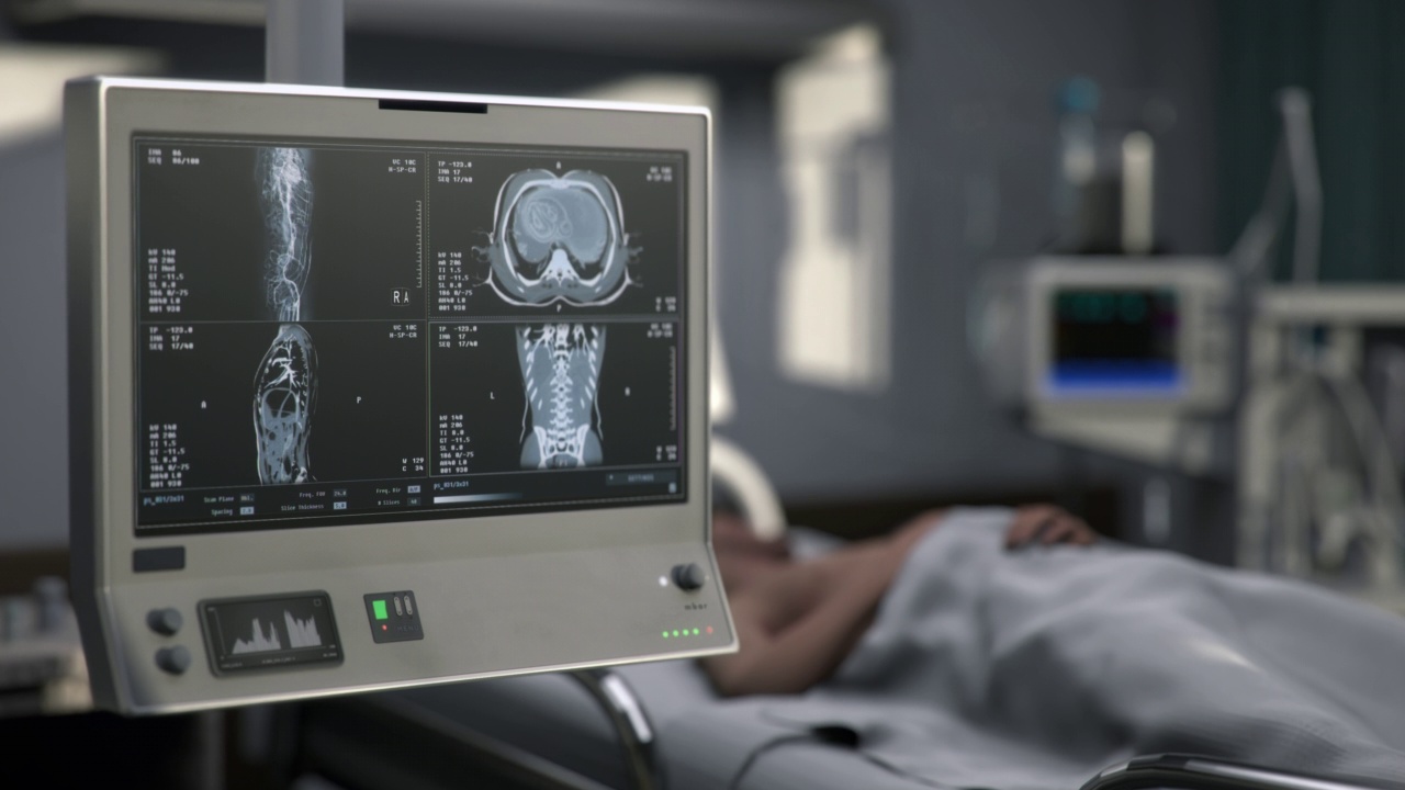 急诊医院x射线扫描仪对病人器官的医学检查视频素材