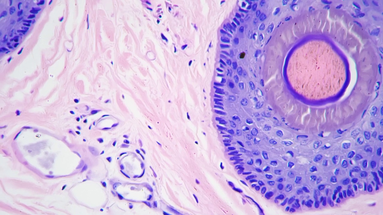 200倍放大显微镜下的人体皮肤及毛囊切片视频素材