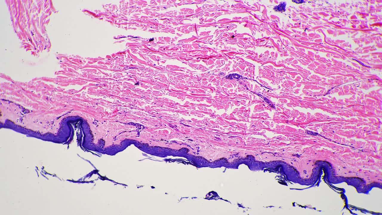 显微镜100倍图像的人类皮肤与汗腺对明亮的领域视频素材