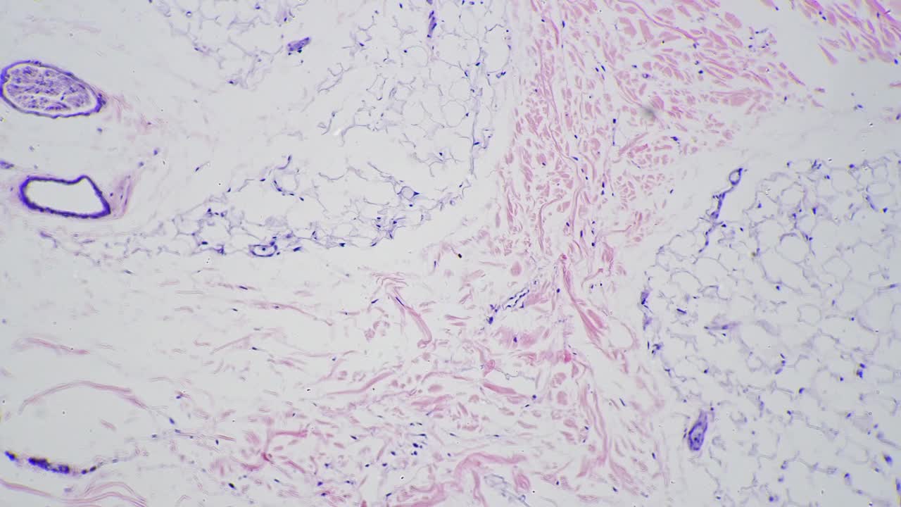 100倍放大显微镜下人体皮肤及毛囊切片视频素材