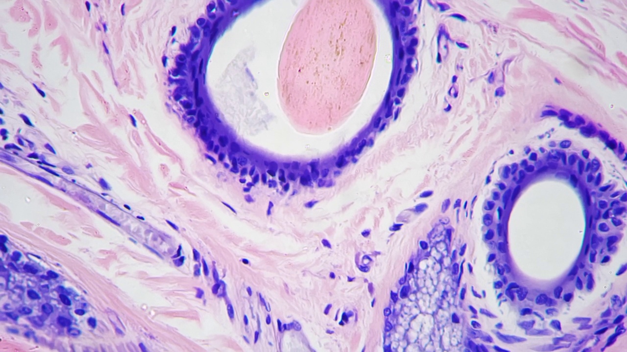 400倍放大显微镜下人体皮肤及毛囊切片视频素材