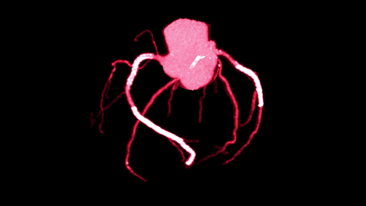 CTA冠状动脉三维绘制。视频素材