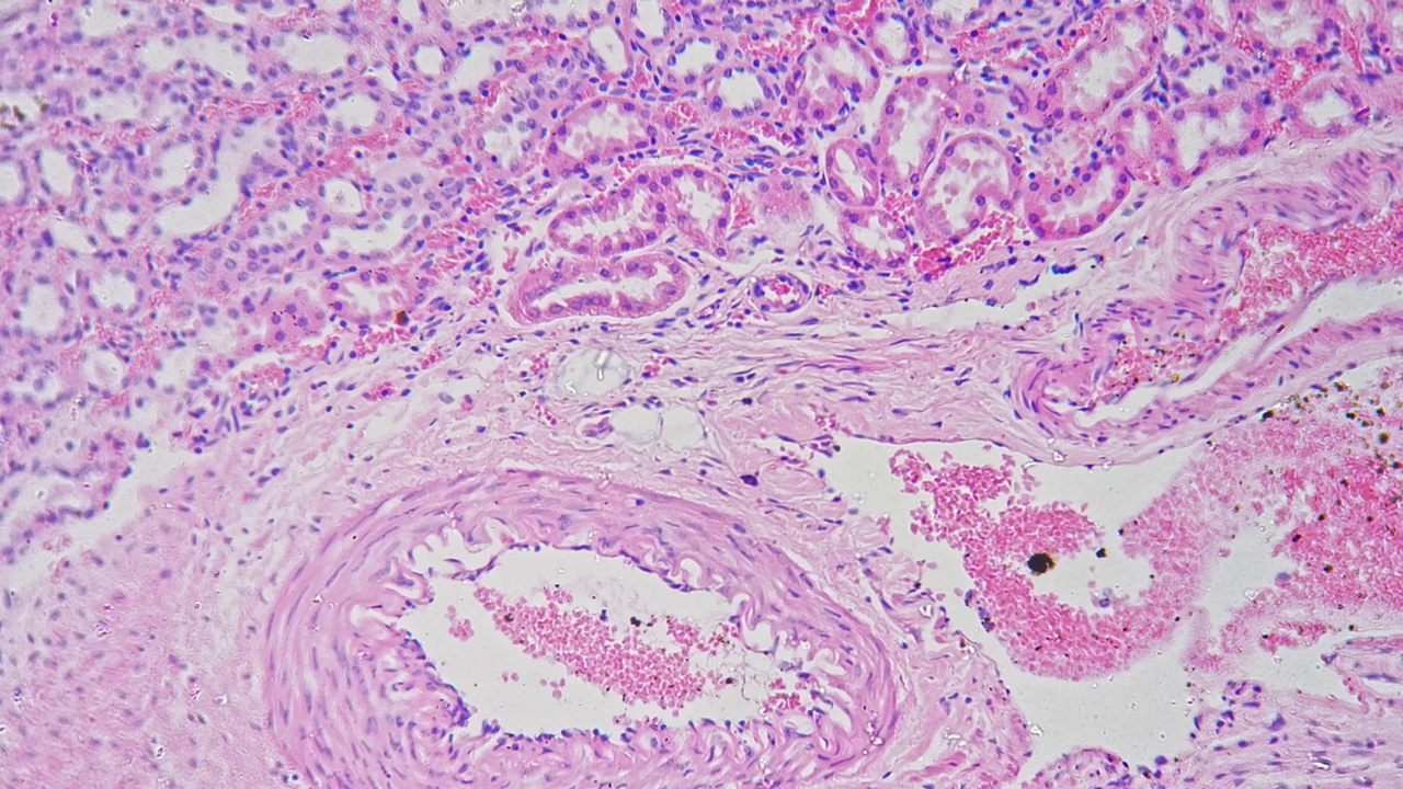 在200倍显微镜下放大动脉和静脉切片，明亮视野拍摄视频素材