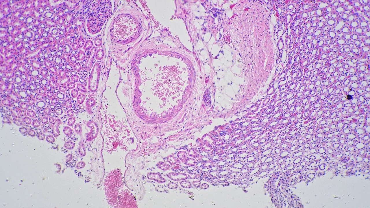 在光镜下100倍放大的动脉和静脉切片视频素材