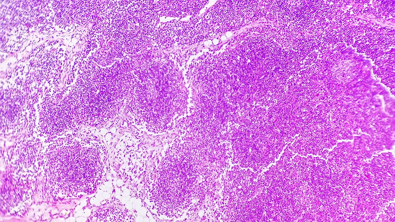 在100倍显微镜下，亮场背景下拍摄淋巴结切片视频素材