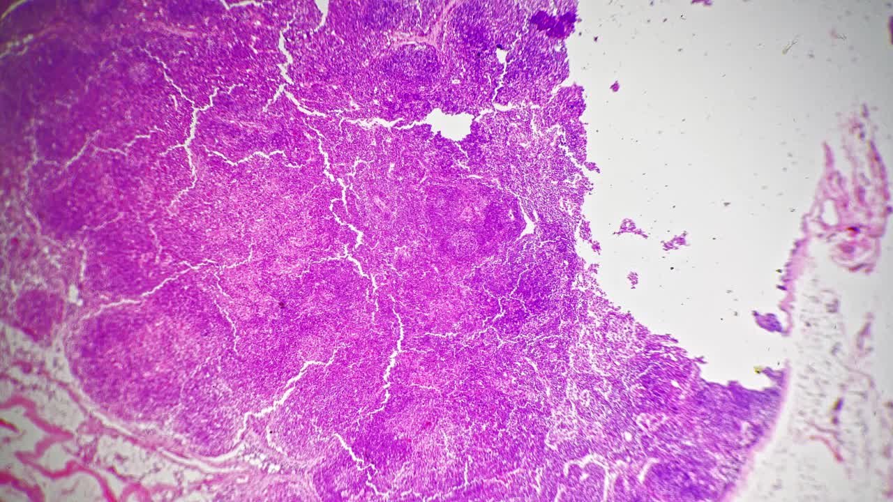 亮场背景下40倍显微镜下淋巴结切片视频素材