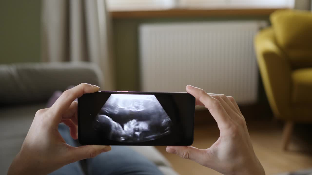 妊娠晚期。孕妇用手机看婴儿的超声波视频。孕妇躺在家里的沙发上看智能手机上的超声波扫描。妇产科分娩。视频素材