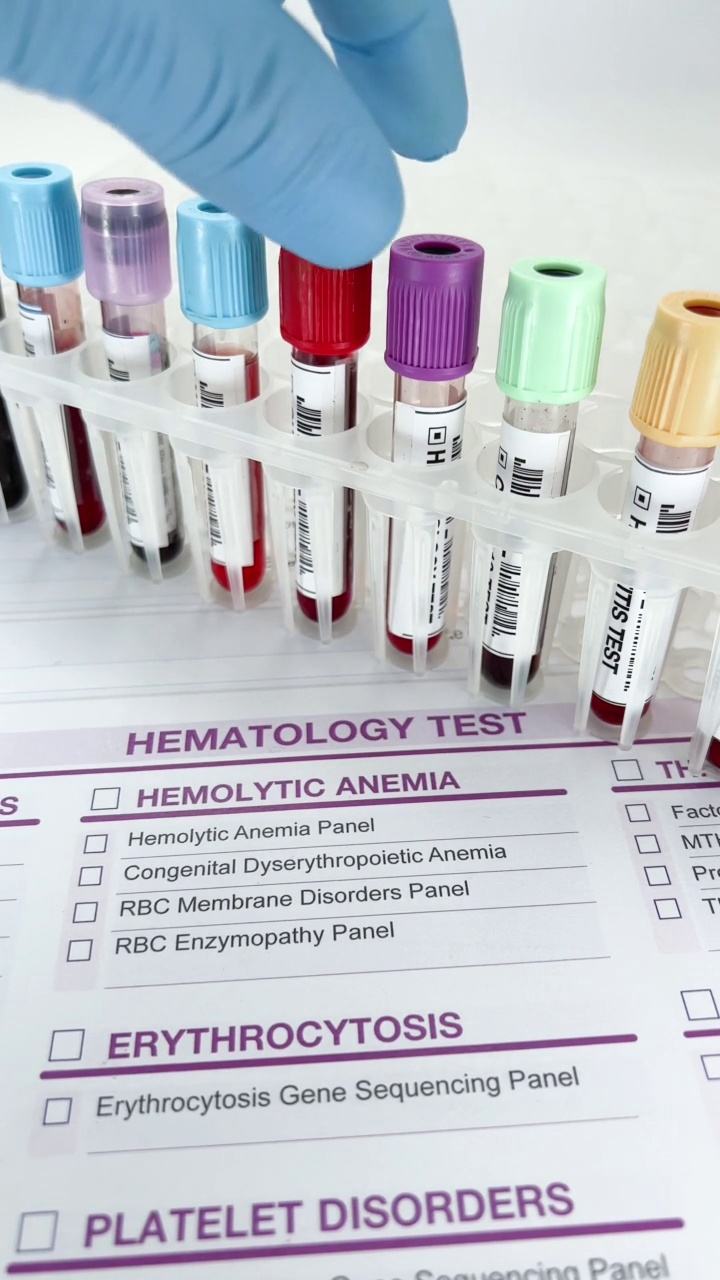 医生拿着血液样本管在血液实验室进行分析视频素材