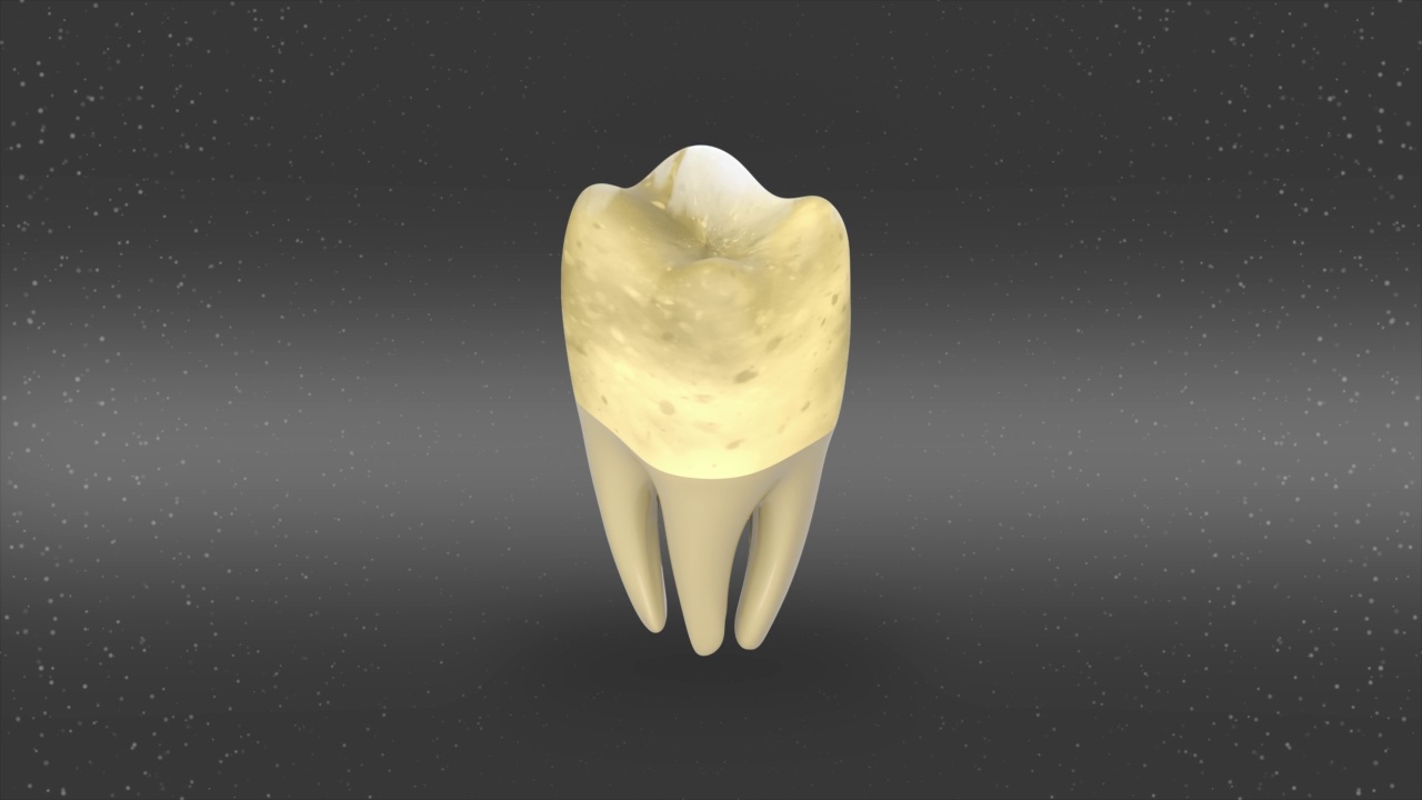 口腔卫生:牙齿清洁超声波刮除。医学上精确的人类牙齿治疗的3D动画。独立的3d视频视频素材