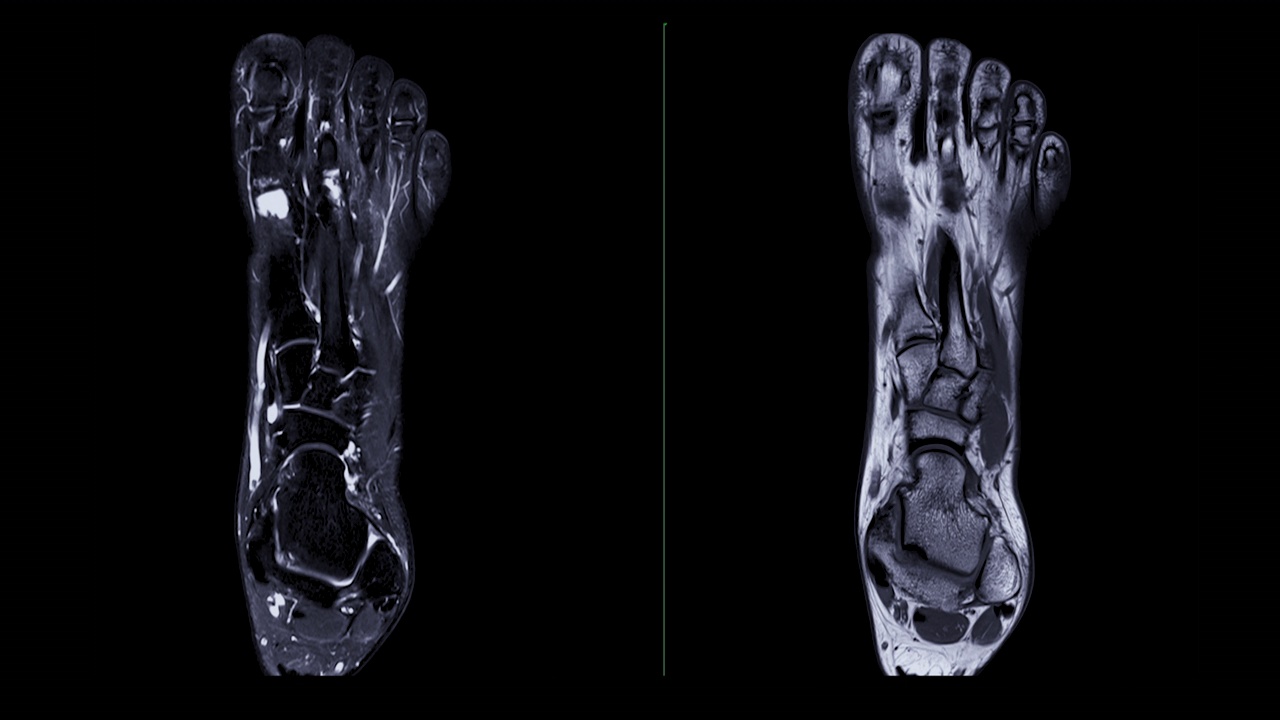足部磁共振成像用于足部诊断。视频素材