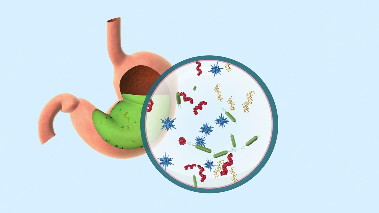 胃里的细菌会引起胃痛和食物中毒视频素材