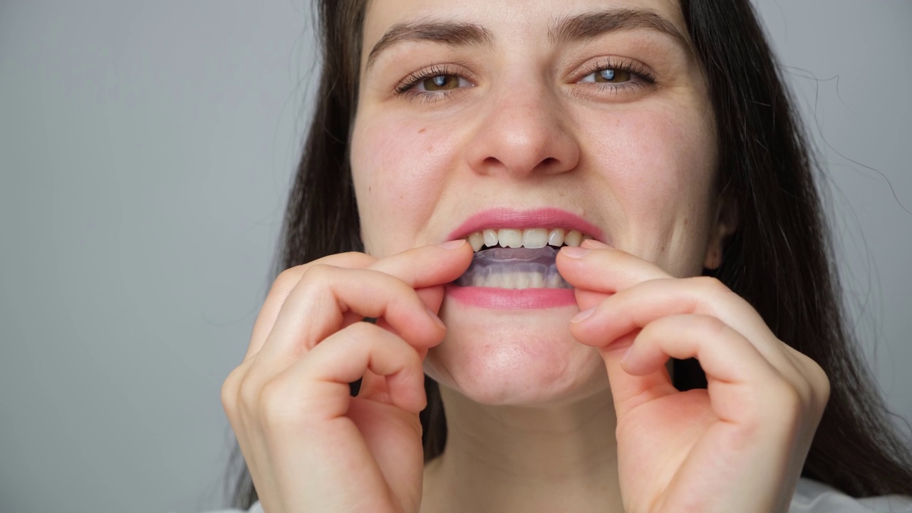 女性在口腔内放入牙套、夹板，用于治疗颞下颌关节功能障碍、磨牙症、错颌，以放松下颌肌肉。视频素材