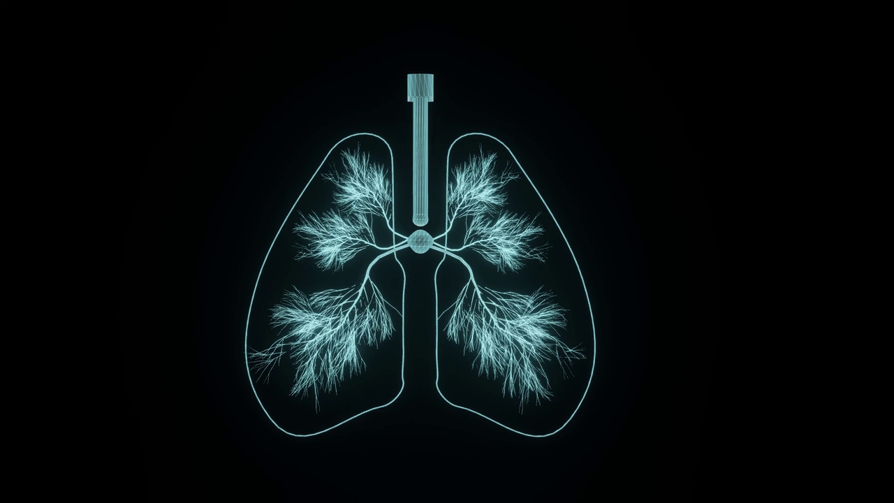 全息3D肺概念用于先进的肺部疾病诊断和肺癌的个性化治疗视频素材