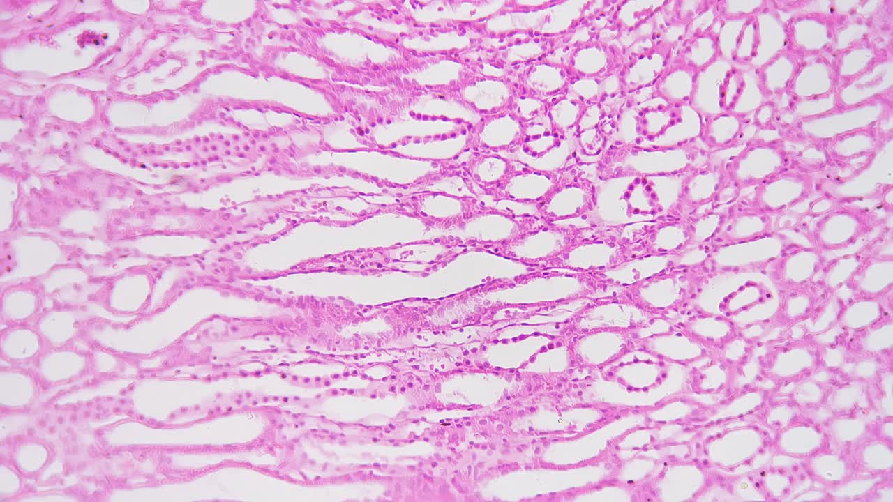 人肾切片在200倍光镜下亮场拍摄视频素材