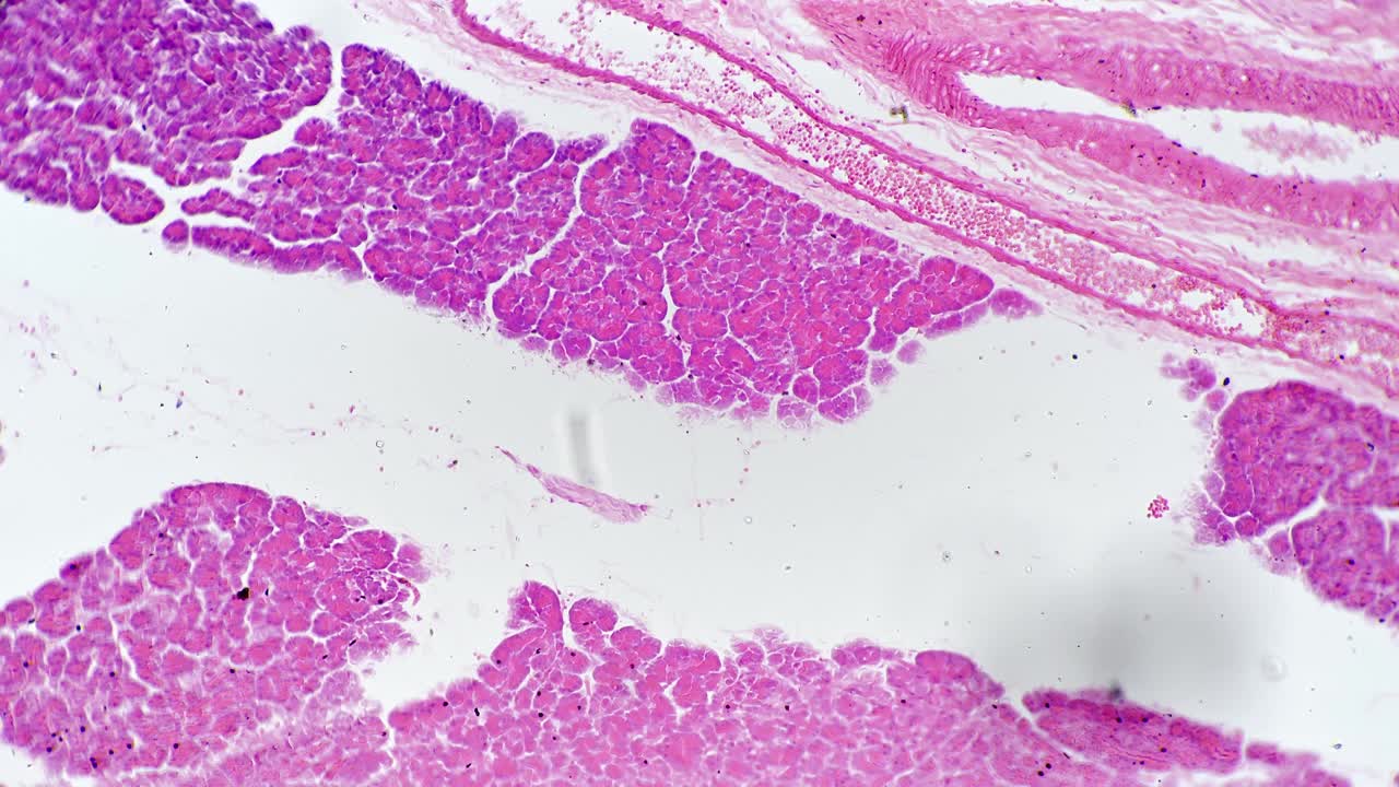 高倍镜下100倍亮场显示人胸腺切片视频素材