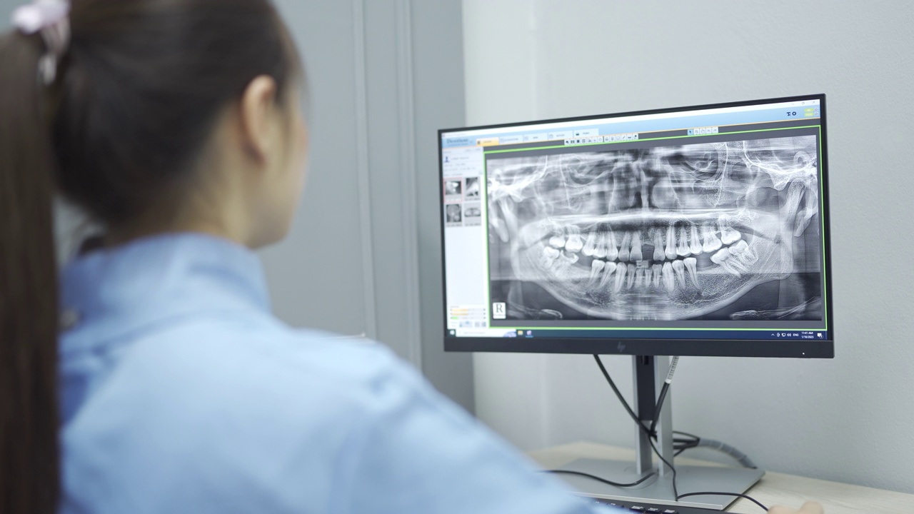 牙医正在检查病人牙齿的数字x光片视频素材