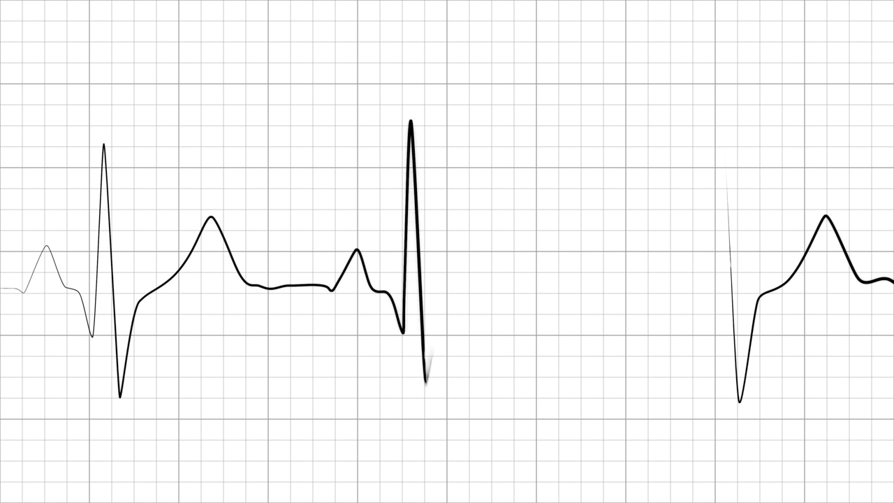 动态心率或心跳线。心电图信号。单色，黑白两色。视频素材