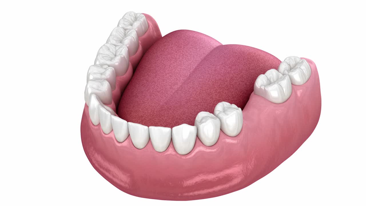 安置牙桥。医学上精确的3D动画视频下载