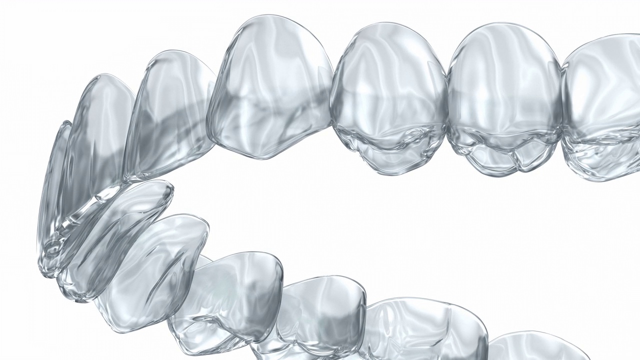 隐形牙套或隐形固位器。牙科3D动画视频下载