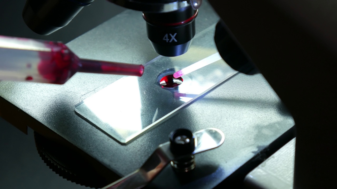 科学实验室显微镜的特写镜头，检查准备好的载玻片上的一滴血液病毒。教育、科学或医药行业视频下载