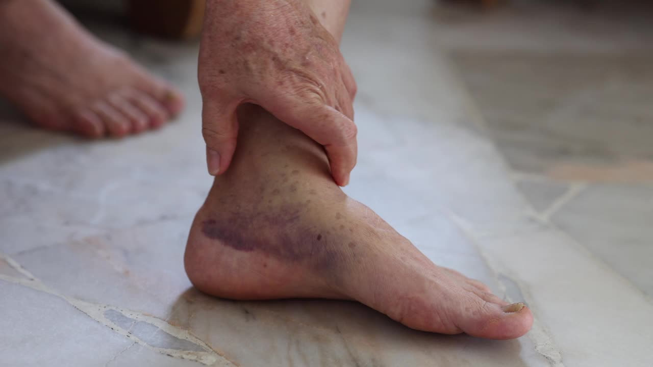 一位资深女性按摩脚部消肿的特写视频素材