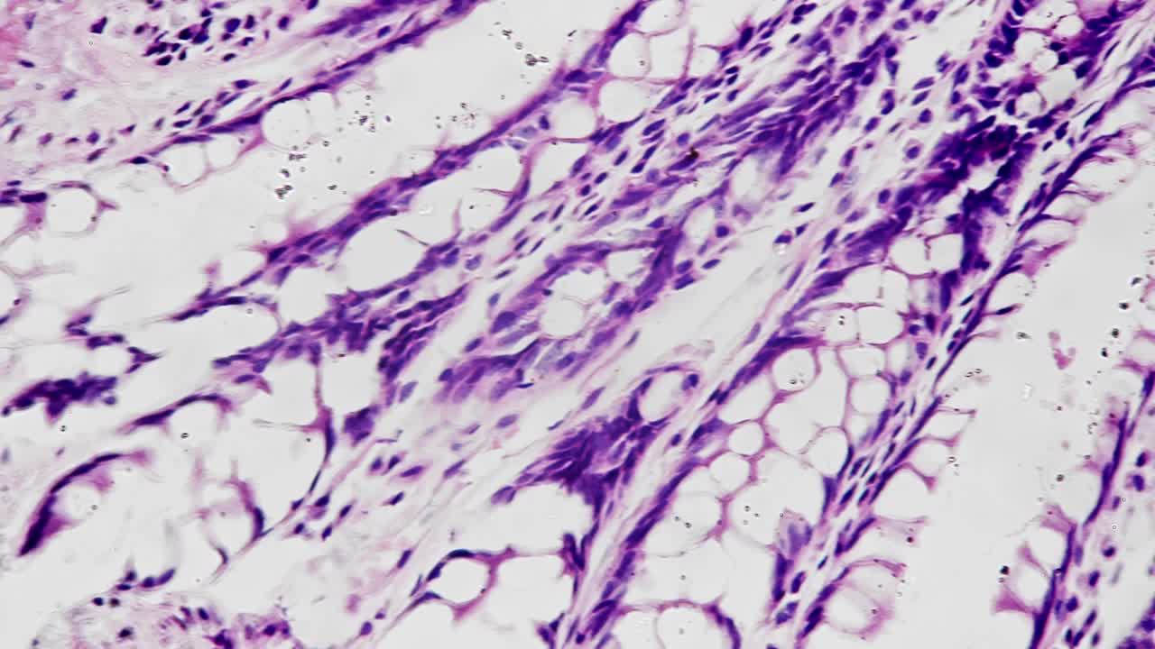 在医院实验室400倍医用显微镜下拍摄的人结肠切片视频素材