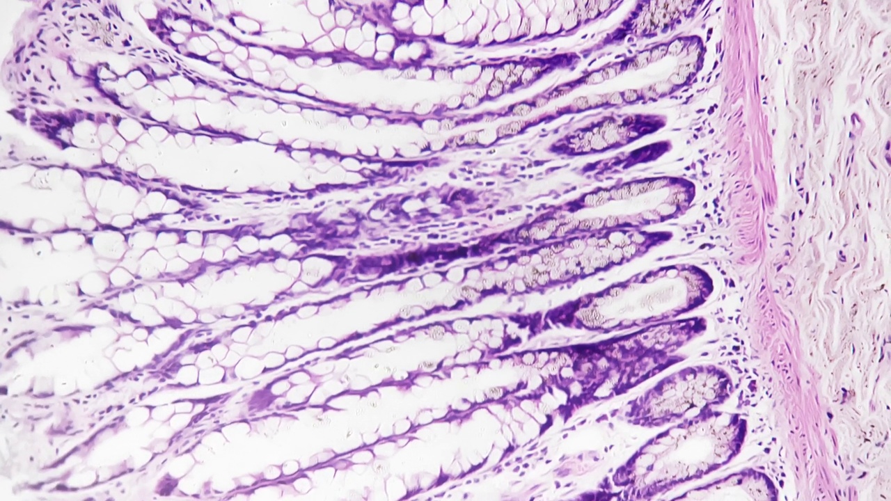 在医院实验室200倍医用显微镜下拍摄的人结肠切片视频素材