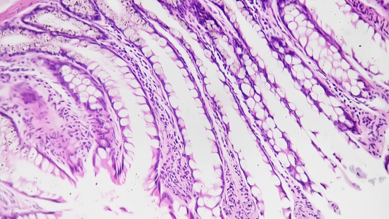 在科学实验室用100倍医学显微镜下拍摄的人体结肠切片视频素材